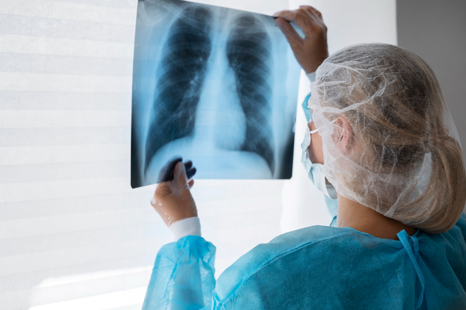 Radon et cancer : quels sont les liens ?
